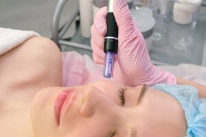 Fibroblast Plasma Lifting и Microneedling